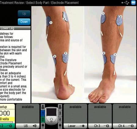 Chattanooga Intelect NEO Stim Module CH. 1&2 - Image 5